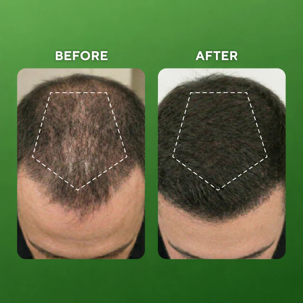 Dr.Medsam Hair Growth Serum